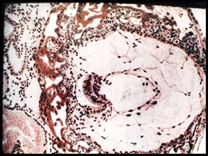 Embriogénesis Temprana, diferenciación de las 3 capas germinativas.